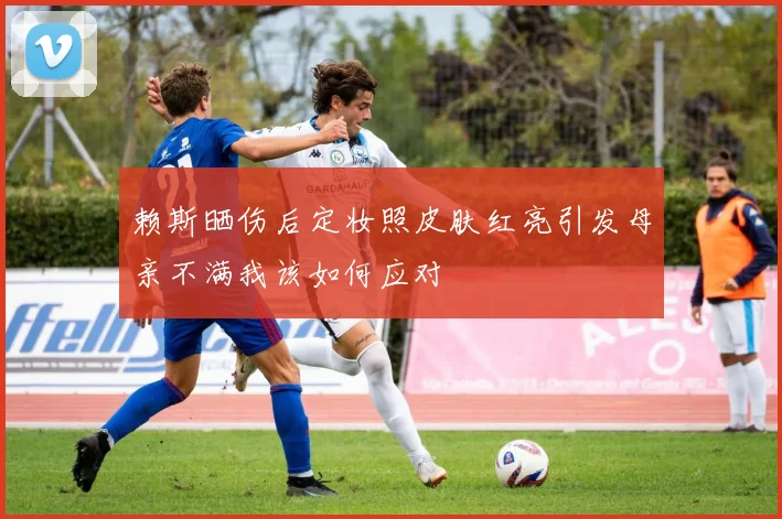 赖斯晒伤后定妆照皮肤红亮引发母亲不满我该如何应对